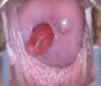 ����Ϣ���ͼƬ