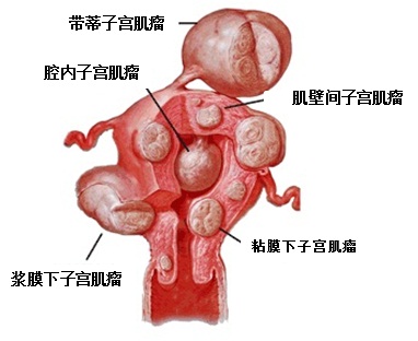 ӹͼƬ
